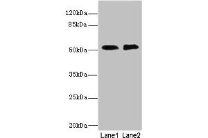 Western blot All lanes: TMOD1 antibody at 2. (CIR1 anticorps  (AA 1-160))