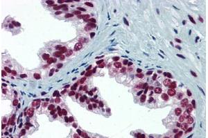 Human Prostate: Formalin-Fixed, Paraffin-Embedded (FFPE) (SP1 anticorps  (AA 89-199))