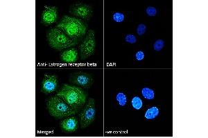 ABIN5539801 Immunofluorescence analysis of paraformaldehyde fixed MCF7 cells, permeabilized with 0. (ESR2 anticorps  (AA 417-428))