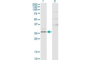 Western Blot analysis of CTRB1 expression in transfected 293T cell line by CTRB1 monoclonal antibody (M02), clone 3C8. (CTRB1 anticorps  (AA 101-200))