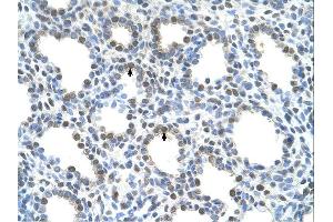Immunohistochemistry (IHC) image for anti-Solute Carrier Family 15 (H+/Peptide Transporter), Member 4 (SLC15A4) (N-Term) antibody (ABIN310554) (SLC15A4 anticorps  (N-Term))