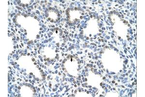Immunohistochemistry (IHC) image for anti-Solute Carrier Family 15 (H+/Peptide Transporter), Member 4 (SLC15A4) (N-Term) antibody (ABIN2781719)