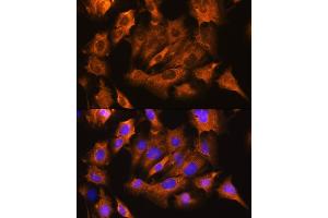 Immunofluorescence analysis of C6 cells using B1 antibody (ABIN6127387, ABIN6137304, ABIN6137307 and ABIN6216023) at dilution of 1:100.