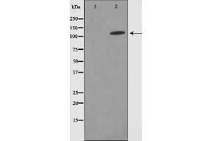 Western blot analysis on HepG2 cell lysate using SUPT16H Antibody，The lane on the left is treated with the antigen-specific peptide. (SUPT16H anticorps  (C-Term))