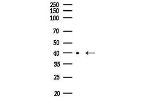 Western blot analysis of lysates from EC304 cells, using Phospho-PKA beta (Thr197)[Thr198] Antibody at 1/1000 dilution.