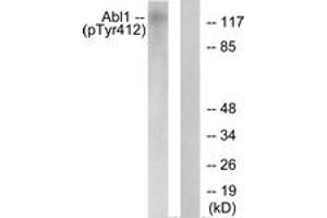 Western blot analysis of extracts from COS7 cells treated with Adriamycin 0. (ABL1 anticorps  (pTyr393))