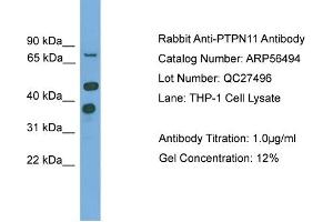 WB Suggested Anti-PTPN11  Antibody Titration: 0. (PTPN11 anticorps  (N-Term))