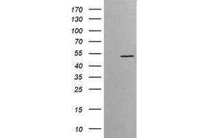 anti-V-Ets Erythroblastosis Virus E26 Oncogene Homolog 2 (ETS2) (AA 90-349) antibody