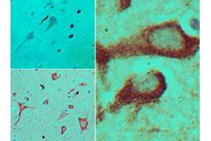 Immunohistochemical analysis of TICAM2 in formalin-fixed, paraffin-embedded human brain tissue using an isotype control (top left) and TICAM2 polyclonal antibody  (bottom left, right) at 5 ug/mL . (TICAM2 anticorps  (AA 87-103))