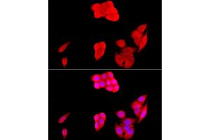 Immunofluorescence analysis of HeLa cells using [KO Validated] SIRT1 Rabbit pAb (ABIN7270322) at dilution of 1:200 (40x lens). (SIRT1 anticorps)