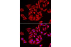 Immunofluorescence analysis of U2OS cells using TLK2 antibody (ABIN5974098). (TLK2 anticorps)