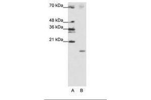 Image no. 2 for anti-Signal Recognition Particle 19kDa (SRP19) (C-Term) antibody (ABIN202029) (SRP19 anticorps  (C-Term))