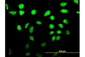 Image no. 1 for anti-A Kinase (PRKA) Anchor Protein 17A (AKAP17A) (AA 53-157) antibody (ABIN599035) (SFRS17A anticorps  (AA 53-157))