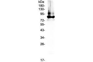 Western blot testing of human plasma lysate with Prothrombin antibody at 0. (Prothrombin anticorps)