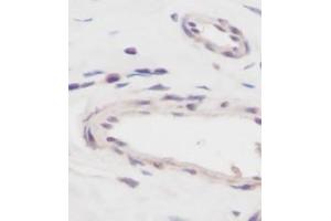 Image no. 5 for anti-Vascular Endothelial Growth Factor A (VEGFA) antibody (ABIN465470) (VEGFA anticorps)