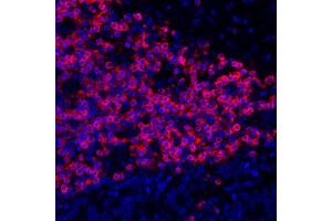 Immunofluorescence (IF) image for anti-CD3 epsilon (CD3E) (AA 157-207) antibody (ABIN7454035) (Recombinant CD3 epsilon anticorps  (AA 157-207))