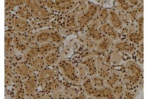 ABIN6261828 and ABIN6274011 at 1/100 staining Rat kidney tissue by IHC-P. (FUBP1 anticorps  (C-Term))