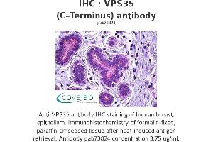 Image no. 1 for anti-Vacuolar Protein Sorting 35 (VPS35) (C-Term) antibody (ABIN1740787) (VPS35 anticorps  (C-Term))