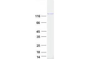 Validation with Western Blot