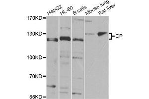 Western blot analysis of extracts of various cell lines, using CP Antibody (ABIN5974460) at 1/1000 dilution. (Ceruloplasmin anticorps)