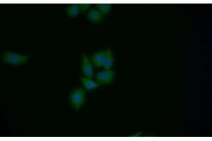Detection of MGEA5 in Human MCF7 cell using Polyclonal Antibody to Meningioma Expressed Antigen 5 (MGEA5) (MGEA5 anticorps  (AA 6-240))