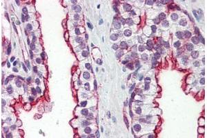 Human Prostate (formalin-fixed, paraffin-embedded) stained with CLU antibody ABIN364331 at 10 ug/ml followed by biotinylated anti-mouse IgG secondary antibody ABIN481714, alkaline phosphatase-streptavidin and chromogen. (Clusterin anticorps  (AA 1-333))