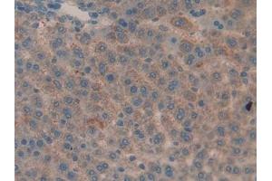 Detection of MMP9 in Rat Liver Tissue using Polyclonal Antibody to Matrix Metalloproteinase 9 (MMP9)