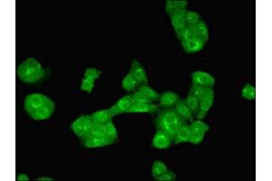 Immunofluorescent analysis of PC-3 cells using ABIN7143886 at dilution of 1:100 and Alexa Fluor 488-congugated AffiniPure Goat Anti-Rabbit IgG(H+L) (ALKBH3 anticorps  (AA 1-170))