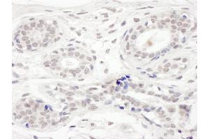 Immunohistochemistry (IHC) image for anti-Bromodomain Containing 8 (BRD8) (AA 225-275), (Isoform 2) antibody (ABIN7454596)