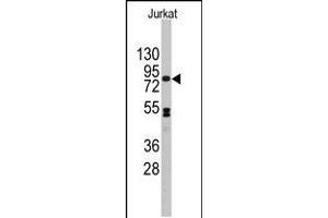 Western blot analysis of anti-CDH12 Antibody in Jurkat cell line lysates (35ug/lane). (Cadherin 12 anticorps  (N-Term))