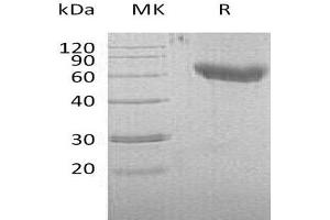 Western Blotting (WB) image for CD28 (CD28) protein (His tag,Fc Tag) (ABIN7320743) (CD28 Protein (CD28) (His tag,Fc Tag))