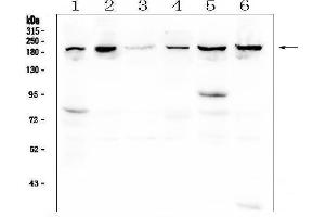 Western blot analysis of CPAMD8 using anti-CPAMD8 antibody (ABIN6719649). (CPAMD8 anticorps  (AA 58-234))