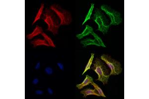 ABIN6258908 and ABIN6275622 staining Hela cells by IF/ICC.