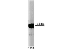 Western Blotting (WB) image for anti-Small Nuclear Ribonucleoprotein Polypeptide N (SNRPN) (AA 14-174) antibody (ABIN968086) (SNRPN anticorps  (AA 14-174))