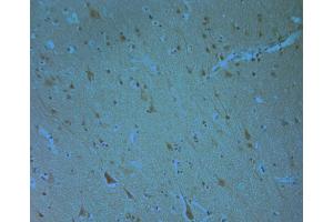 human brain-4 (ERK1/2 anticorps  (pThr202, pTyr204))