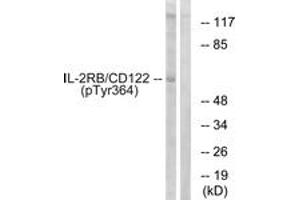 Western blot analysis of extracts from COS7 cells, using IL-2R beta/CD122 (Phospho-Tyr364) Antibody. (IL2 Receptor beta anticorps  (pTyr364))