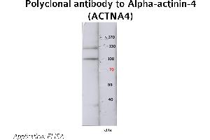 Image no. 1 for anti-Actinin, alpha 4 (ACTN4) (N-Term) antibody (ABIN347113) (alpha Actinin 4 anticorps  (N-Term))