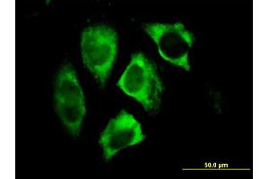 Immunofluorescence of monoclonal antibody to PARK2 on HeLa cell. (Parkin anticorps  (AA 288-387))