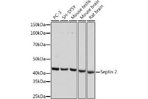 Western blot analysis of extracts of various cell lines, using Septin 2 Rabbit mAb (ABIN7270203) at 1:1000 dilution. (Septin 2 anticorps)