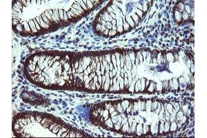 Immunohistochemical staining of paraffin-embedded Human colon tissue using anti-TBCC mouse monoclonal antibody. (TBCC anticorps)