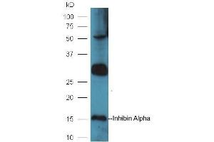 Mouse intestinal lysates probed with Rabbit Anti-Inhibin Alpha Polyclonal Antibody, Unconjugated (ABIN1715125) at 1:300 in 4˚C. (Inhibin alpha anticorps  (AA 281-366))
