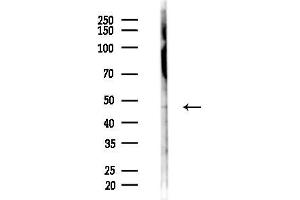 Western blot analysis of lysates from COLO205 cells(starvation 24h treatment), using ADR Antibody at 1/1000 dilution.