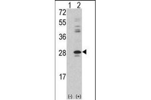 Western blot analysis of PRKCDBP (arrow) using rabbit polyclonal PRKCDBP Antibody (Center) (ABIN392215 and ABIN2841911).