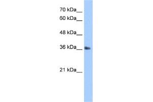 WB Suggested Anti-TIPIN Antibody Titration:  5. (TIPIN anticorps  (N-Term))