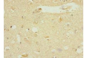 Immunohistochemistry of paraffin-embedded human brain tissue using ABIN7150519 at dilution of 1:100