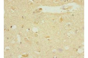 Immunohistochemistry of paraffin-embedded human brain tissue using ABIN7150519 at dilution of 1:100 (DNAJB2 anticorps  (AA 215-324))