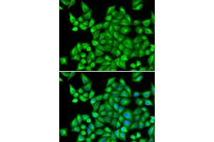 Immunofluorescence analysis of HeLa cells using DHRS9 antibody. (DHRS9 anticorps)