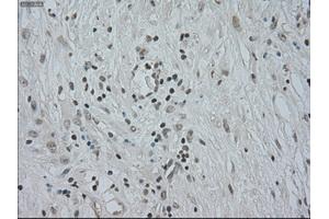 Immunohistochemistry (IHC) image for anti-Cancer/testis Antigen 1B (CTAG1B) antibody (ABIN1499899)