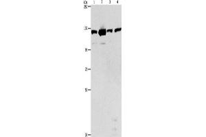 Western Blotting (WB) image for anti-PTK2 Protein tyrosine Kinase 2 (PTK2) antibody (ABIN2422853) (FAK anticorps)