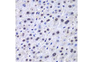 Immunohistochemistry of paraffin-embedded human liver injury using APEX1 antibody at dilution of 1:100 (400x lens). (APEX1 anticorps)